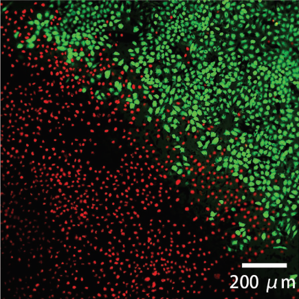   
		Figure 3. Fluorescence microscopic image of the cells after the magnetic hyperthermia process generated by the shrinking state microrobotic swarm. Living cells are with green color and dead ones are in red color.	 
